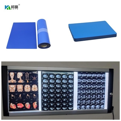 210 μικρού Inkjet ακτίνας X ιατρικά μπλε φύλλα ταινιών 8x10 13x17 14x17 A4 A3 100 βάσεων ξηρά