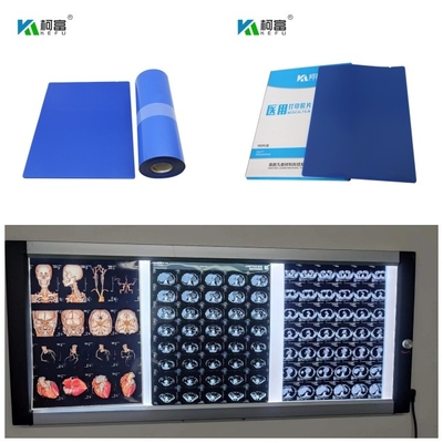 Ιατρική μπλε ταινία ακτίνας X Inkjet βάσεων ο ΔΡ CT MRI μελάνι 14inch Χ ρόλος 10x12 χρωστικών ουσιών 125 φύλλων