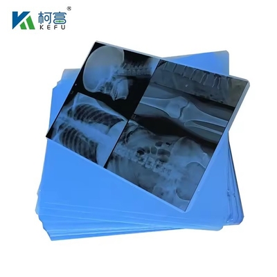 Α4 ιατρικό μελάνι Jet Blue Film X-Ray PET Film X-Ray χαρτί