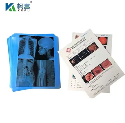 CT Scanner ξηρό ακτινογραφικό 24x30 ιντσών φιλμ Inkjet πράσινη μπλε βάση ιατρική ακτινογραφική ταινία