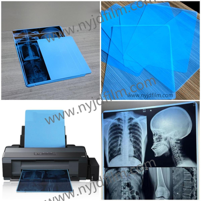 210 μπλε ακτίνας X ταινιών ιατρικών Inkjet μικρά ταινιών εκτύπωσης για το νοσοκομείο