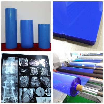 ISO9001 μπλε Inkjet ταινία 11*14In εκτύπωσης Inkjet ταινιών ιατρική