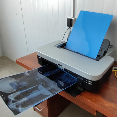 14*17 ιατρική Inkjet ίντσας μπλε ταινία εκτυπωτών της Canon Epson Inkjet ταινιών της PET