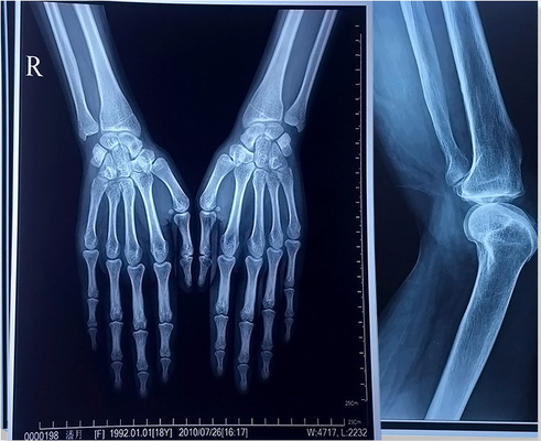 14x17 Φίλμ Laser X-ray FUJI DI-HL 14x17&quot; 35x43cm Φίλμ Medical Laser Φίλμ Fuji Dry Film