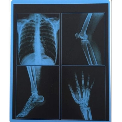 25cm X 30cm μπλε διαφάνειας της PET θερμική ταινία απεικόνισης ταινιών ιατρική ξηρά για το νοσοκομείο
