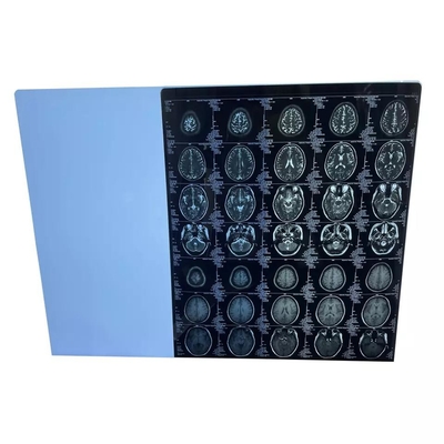 Αντιστατική ιατρική ξηρά ταινία 25cmx35cm απεικόνισης λέιζερ του Φούτζι ταινιών