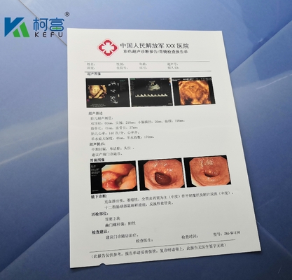 A4 B5 16K 125um άσπρη στιλπνή Inkjet ακτίνας X ταινία απεικόνισης ταινιών ιατρική ξηρά