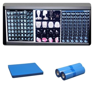 Ο ΔΡ CT MRI ιατρικές Inkjet ταινίες ακτίνας X 210 μπλε βάσεων μικρά ρόλων μελανιού 8x10 A4 A3 10inch