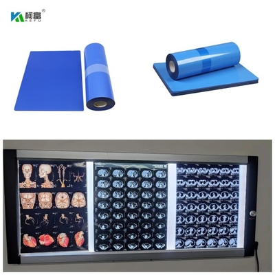Μπλε βάσεων ταινία ακτίνας X Inkjet ιατρική 210 φύλλα ρόλων 8x10 14x17 A4 A3 100 Micorn 10inch