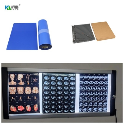 Μπλε βάσεων ξηρές ταινίες ακτίνας X Inkjet ιατρικές ο ΔΡ CT MRI φύλλα μελανιού 8x10 A4 A3 100 χρωστικών ουσιών