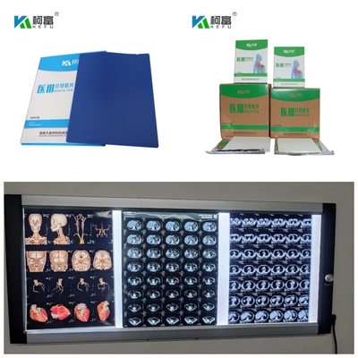 Ο ΔΡ CT MRI ιατρικά Inkjet ξηρά φύλλα μελανιού 8x10 13x17 A4 A3 χρωστικών ουσιών ταινιών ακτίνας X 280gsm