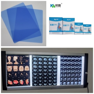 Μπλε ξηρά ταινία Inkjet βάσεων ιατρική ο ΔΡ CT MRI ακτίνα X 210 μικρά ρόλων 8x10 A4 A3 14inch