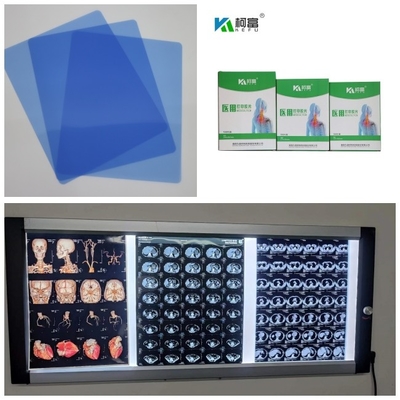 Ο ΔΡ CT MRI ιατρικές Inkjet ταινίες ακτίνας X 210 μπλε βάσεων μικρά ρόλων μελανιού 8x10 A4 A3 10inch