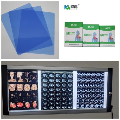 Μπλε βάση Inkjet ταινιών ακτίνας X παραγωγής 280gsm ιατρική για το ΔΡ CT MRI εικόνα 10x12 11x14 A4 A3