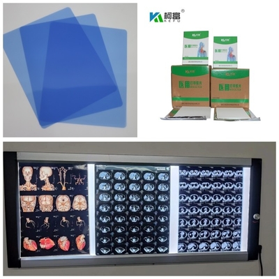 150 μm Inkjet X Ray Τύπο Τύπου Ταχύτητα 1-3 λεπτά Για ιατρική 10 ιντσών