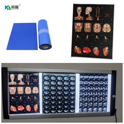 Μπλε ταινία ακτίνας X Inkjet βάσεων ιατρική για την ψηφιακή εικόνα 280gsm για την εικόνα χρώματος 14x17inch