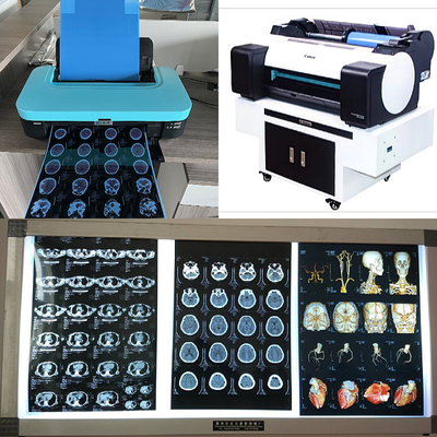 210um Inkjet ιατρική ακτίνας X μπλε βάση ίντσας παραγωγής 8x10 14X17 εικόνας CT MRI ταινιών τρισδιάστατη