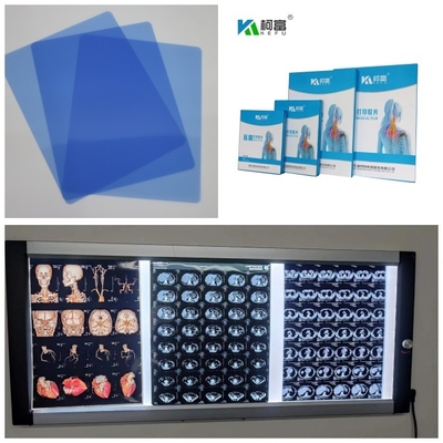 CT ο ΔΡ MRI Inkjet ιατρική ακτίνας X ίντσα παραγωγής 8x10 11x14 14X17 εικόνας ταινιών τρισδιάστατη