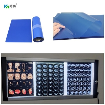 210microns ιατρική ταινία ακτίνας X Inkjet για το CT ο ΔΡ MRI και τρισδιάστατη παραγωγή 14x17 εικόνας CT MRI