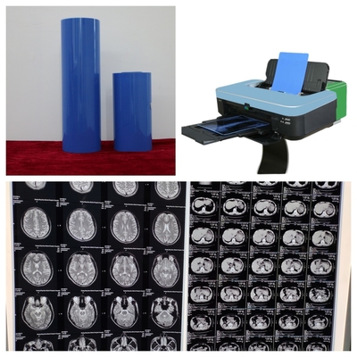 210 μm Blue Base Inkjet Printing X Ray Film με ανάλυση 9600x2400dpi για A3+ CR DR