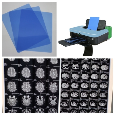 210 μικρών Γαλάζια μελάνι X Ray ταινία MRI εικόνα έξοδος με υψηλή ποιότητα εκτύπωσης για μαύρο λευκό