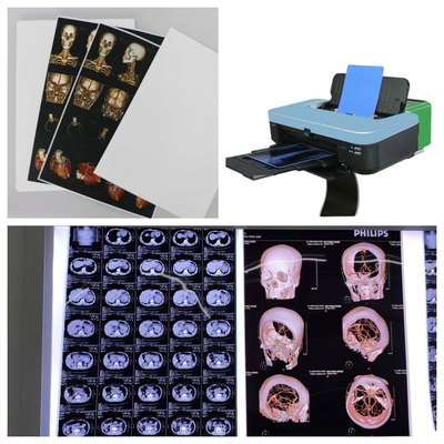 9600x2400dpi Inkjet X Ray Film PET Blue Διαφανής για ιατρική απεικόνιση υψηλής ανάλυσης