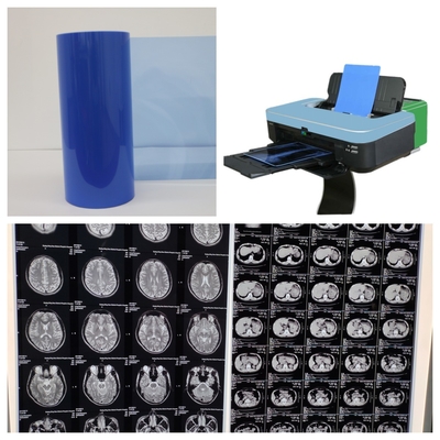 17inch Inkjet X Ray Film για ιατρική απεικόνιση 8x10 10x12 11x14 14x17 A4 A3 A3+ 13X17
