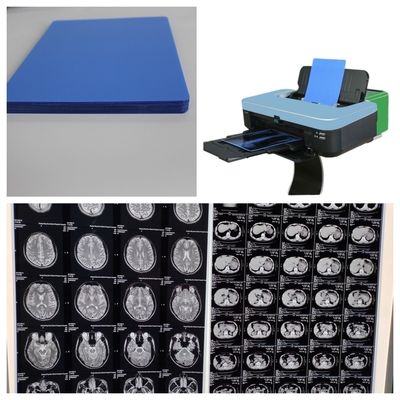 150 μm Inkjet X Ray Τύπο Τύπου Ταχύτητα 1-3 λεπτά Για ιατρική 10 ιντσών