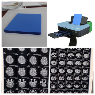 Λογικό κόστος Inkjet X Ray ταινία με υψηλή ποιότητα εκτύπωσης μακρά διάρκεια 17 ιντσών