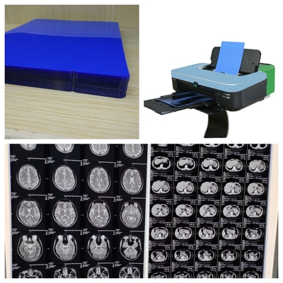 210 μικρών PET Inkjet X Ray Film 14 ιντσών με υψηλή σταθερότητα εικόνας