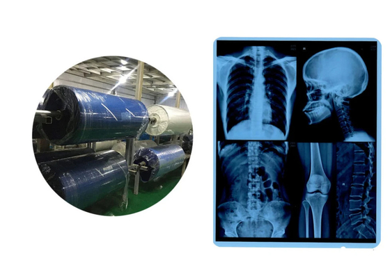 Ιατρική ταινία Γαλάζια θερμική ταινία 210μμ CT DR ταινία 8x10 10x12 11x14 14x17 φύλλο για ιατρικά μέσα εκτύπωσης