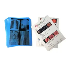 Συμβατότητα Canon / Epson Inkjet εκτυπωτές Inkjet X Ray Film 210 μικρών Σφίξιμο μπλε φιλμ
