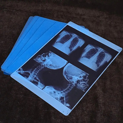 Υψηλής εκτύπωσης μεμβράνη X Ray Film Blue Film πάχος 210 μικρών Blue διαφανής