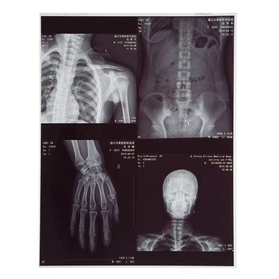 210 μικρών Χ- ακτινοβολία Φόρμα Ιατρική Inkjet Laser Για CT Dr Mr