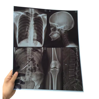 Ξηρό Pix X Ray Film Fuji DIHL X Ray Ιατρική ξηρή απεικόνιση λέιζερ X Ray Film