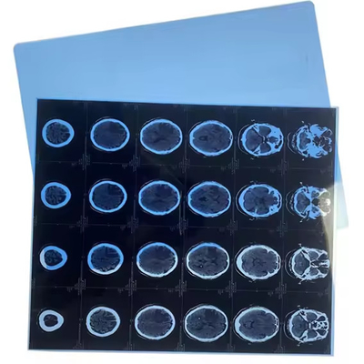 Ιατρική ταινία ακτινογραφίας με μελάνι Di-hl Xray Film Ιατρική ταινία ακτινογραφίας D Speed