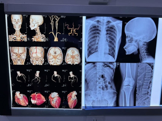 Καλή μονόπλευρη υγρασία Laser X Ray Film Laser Film Μπλε χρώμα