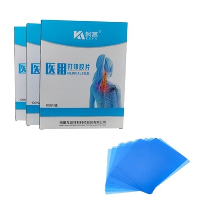 Ιατρική εικόνα CT DR Inkjet Blue Film Ιατρική ακτινογραφία PET Film A4