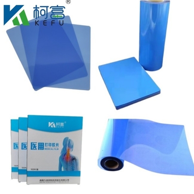 Ιατρική εικόνα CT DR Inkjet Blue Film Ιατρική ακτινογραφία PET Film A4