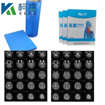 Ιατρική εικόνα CT DR Inkjet Blue Film Ιατρική ακτινογραφία PET Film A4