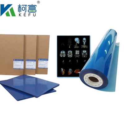 Προσαρμοσμένο μέγεθος 35x43 Inkjet Blue Medical X Ray Film για Epson A4 PET Dry Blue Medical Laser Xray