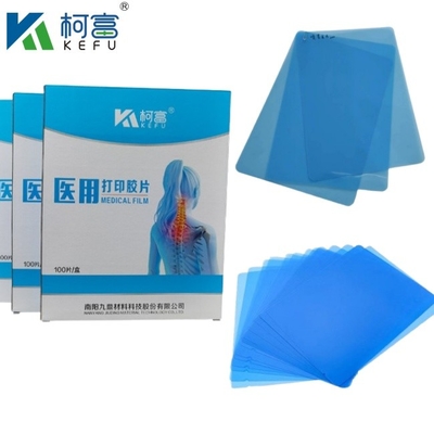 Προσαρμοσμένο μέγεθος Inkjet Blue Medical X Ray Film για την Epson A4 A3 PET Dry Blue Medical Laser Xray σε πώληση