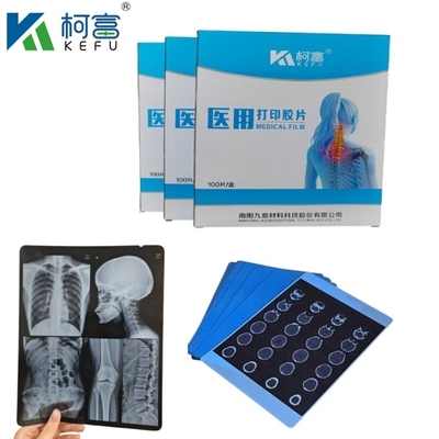 Προσαρμοσμένο μέγεθος Inkjet Blue Medical X Ray Film για την Epson A4 A3 PET Dry Blue Medical Laser Xray σε πώληση