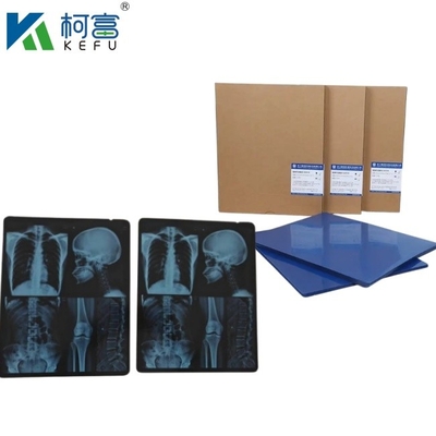 Προσαρμοσμένο μέγεθος Inkjet Blue Medical X Ray Film για την Epson A4 A3 PET Dry Blue Medical Laser Xray σε πώληση
