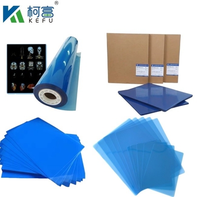Προσαρμοσμένο μέγεθος Blue PET με βάση το X Ray Inkjet/ Laser Film Ιατρικές εικόνες για κλινικές και νοσοκομεία