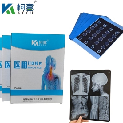 Προσαρμοσμένο μέγεθος Blue PET με βάση το X Ray Inkjet/ Laser Film Ιατρικές εικόνες για κλινικές και νοσοκομεία