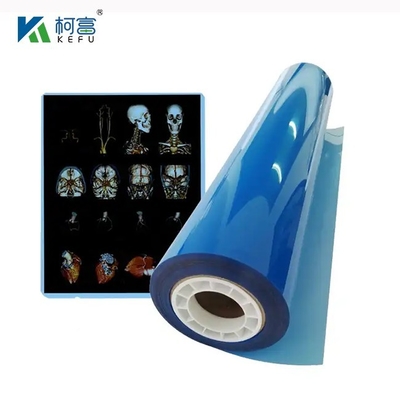 Ιατρική ταινία ακτινογραφίας Inkjet ταινία για Inkjet εκτυπωτή λευκή μπλε ταινία ακτινογραφίας
