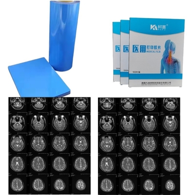 Ιατρική εικόνα στεγνό PET Inkjet Laser Ιατρική ταινία ακτινογραφίας 14x17 ιντσών