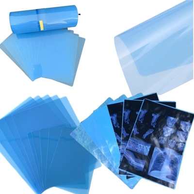 CT Scanner ξηρό ακτινογραφικό A3 / A4 Ιατρικό μελάνι Jet Blue Film X-ray PET Film