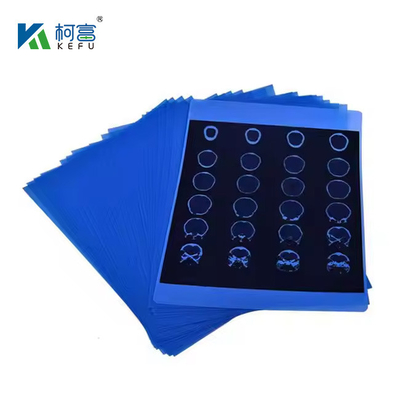 Μεταλλική μεμβράνη με ακτινοβολία X-RAY Blue Film 210micron CT DR Film A4 8x10 Sheet Or Roll Για ιατρικά μέσα εκτύπωσης μεμβράνης